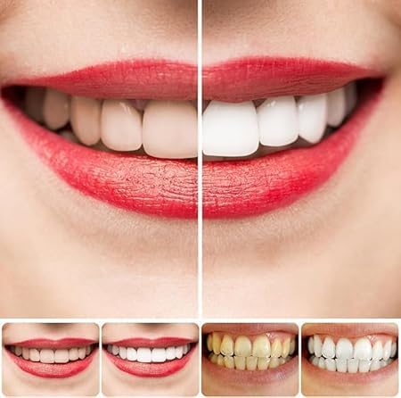 SP-4 Probiotic Whitening Toothpaste