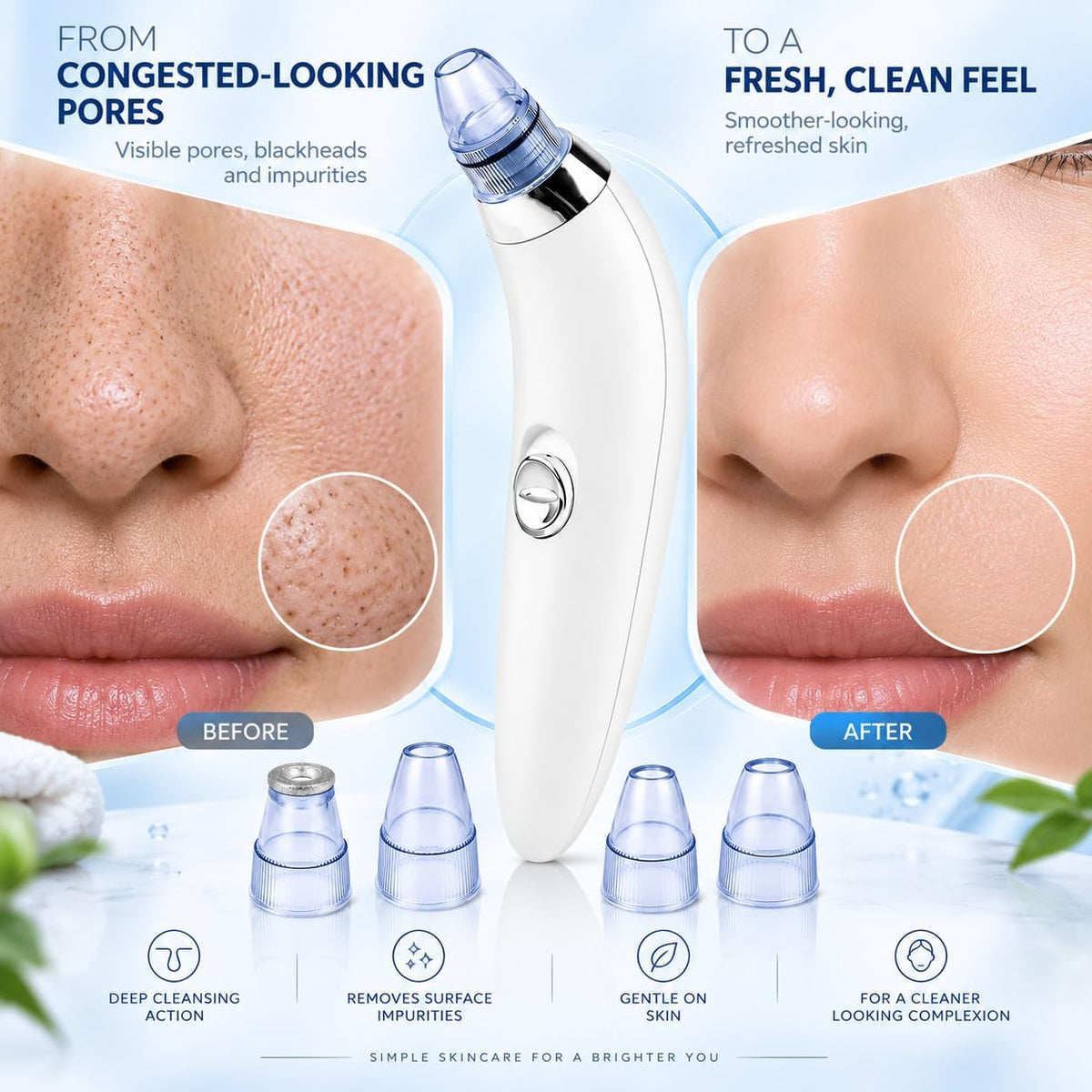PorePerfect™ Blackhead Remover – Vacuum Pore Cleanser